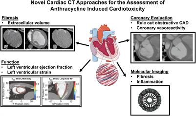 Novel Cardiac Computed Tomography Methods for the Assessment of Anthracycline Induced Cardiotoxicity